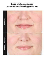1% BHA Gentle Exfoliating Gel Toner