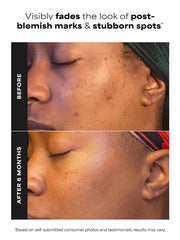10% Azelaic Acid Booster
