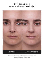 1% Retinol Treatment