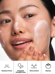 Extra Strength Acne Trio