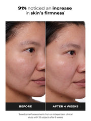 1% Retinol Treatment