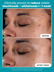2% BHA Exfoliating Toner Pads