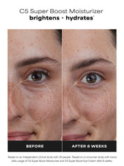 C5 Super Boost Moisturizer
