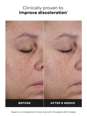 25% Vitamin C + Glutathione Clinical Serum