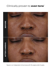 25% Vitamin C + Glutathione Clinical Serum