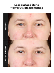 4% BHA Advanced Exfoliating Serum Toner